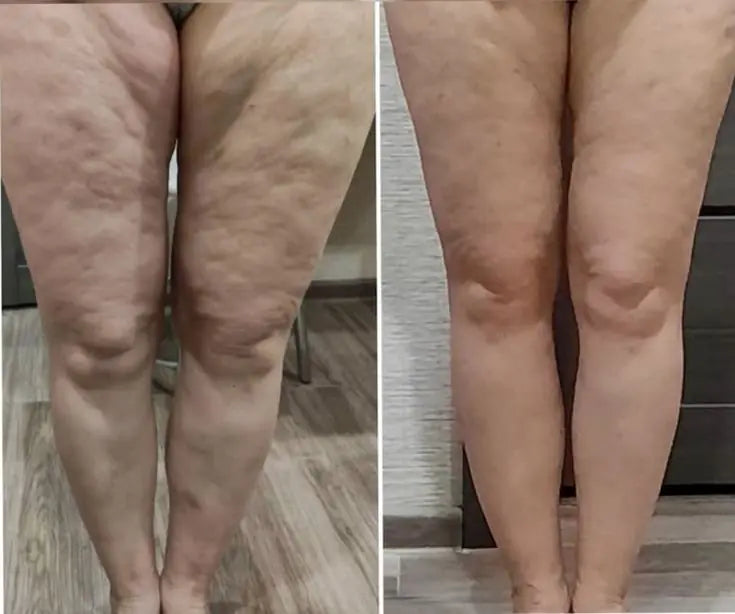 Side-by-side comparison: legs